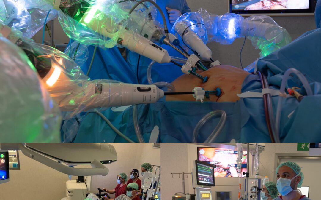 Bellvitge, referent en cirurgia robòtica amb la incorporació del robot Versius