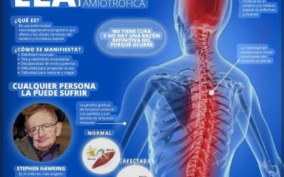 VOX El Prat presenta una moció per donar suport a les persones afectades per l’ELA i les seves famílies