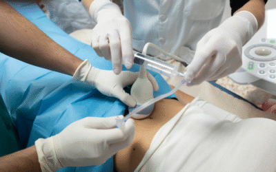 Bellvitge obre camí amb una alternativa menys invasiva per a l’endometriosi
